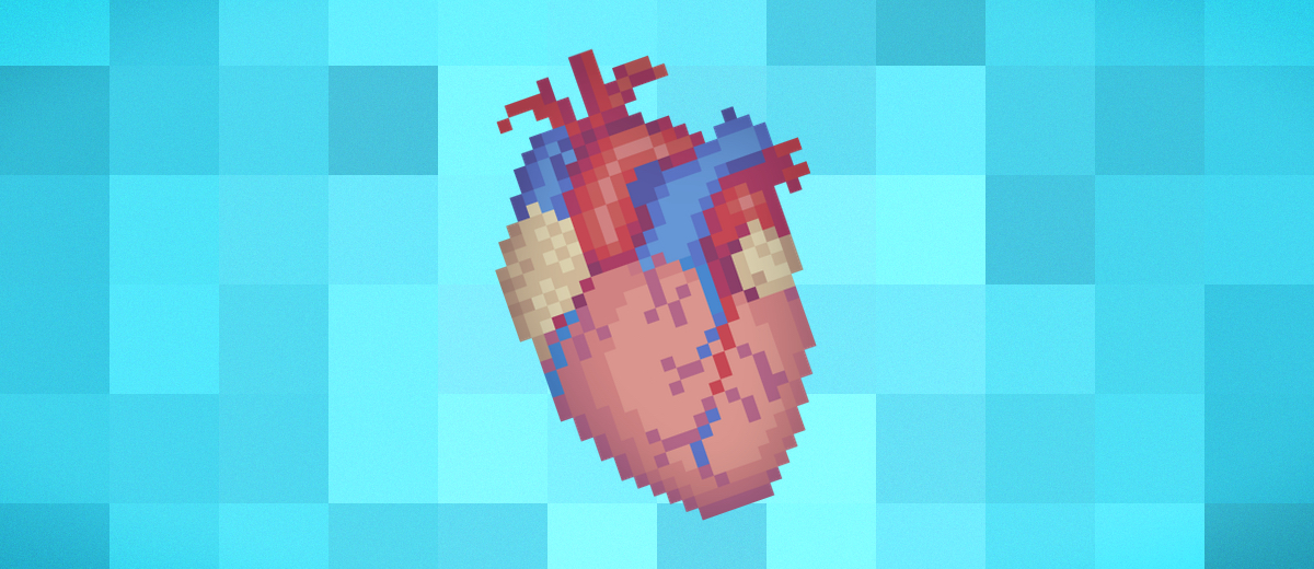 Cardiac Pathology Quiz Geeky Medics