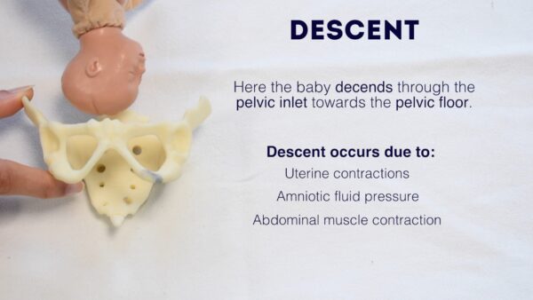 Fetal descent