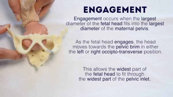 Fetal engagement
