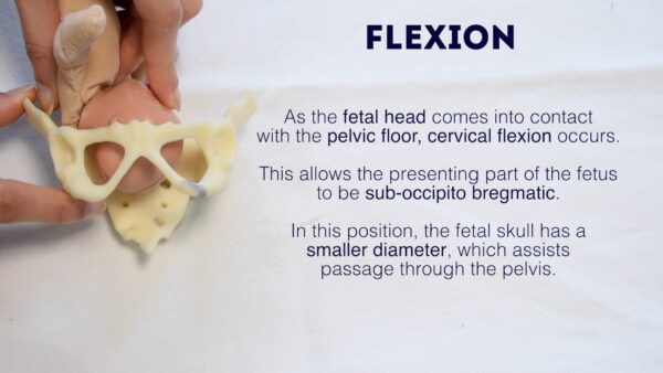 Fetal head flexion