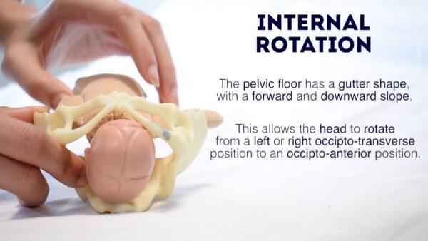 Fetal internal rotation