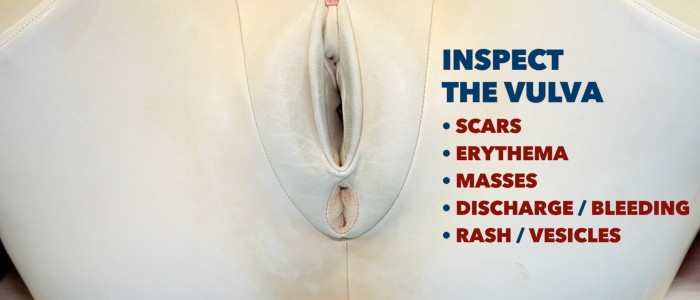 Inspect Vulva