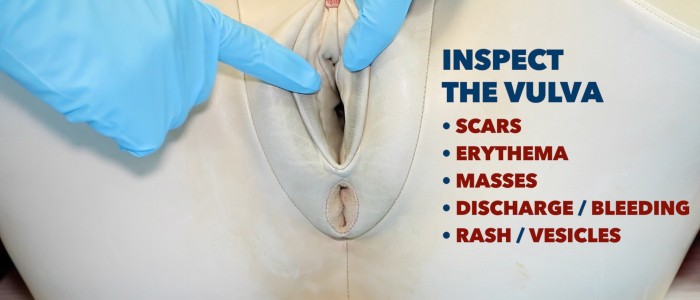 Inspect the vulva