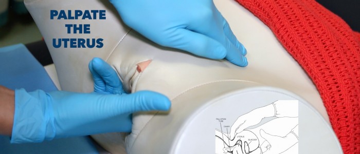 Palpate and assess the uterus bimanually