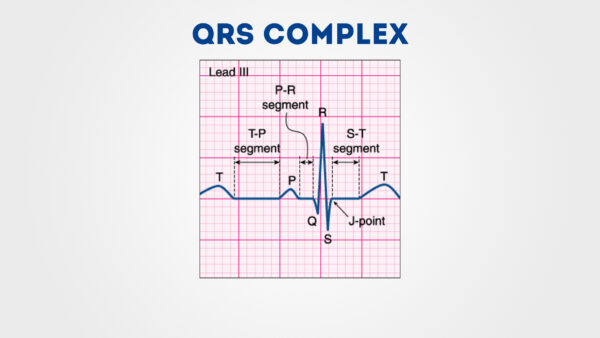 QRS complex