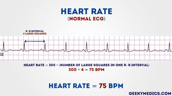 ECG - Heart Rate (normal)