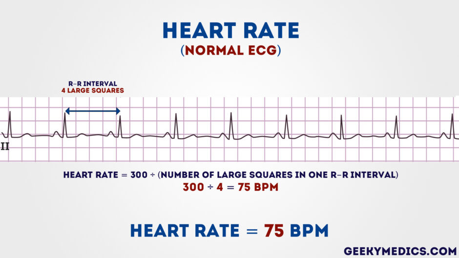 normal heartbeat per minute during pregnancy