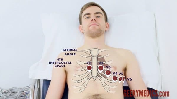 Chest electrode positions