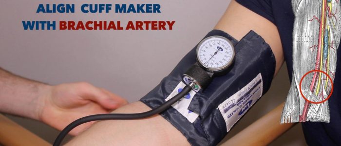 Attach blood pressure cuff