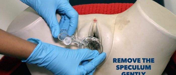 Gently remove the speculum