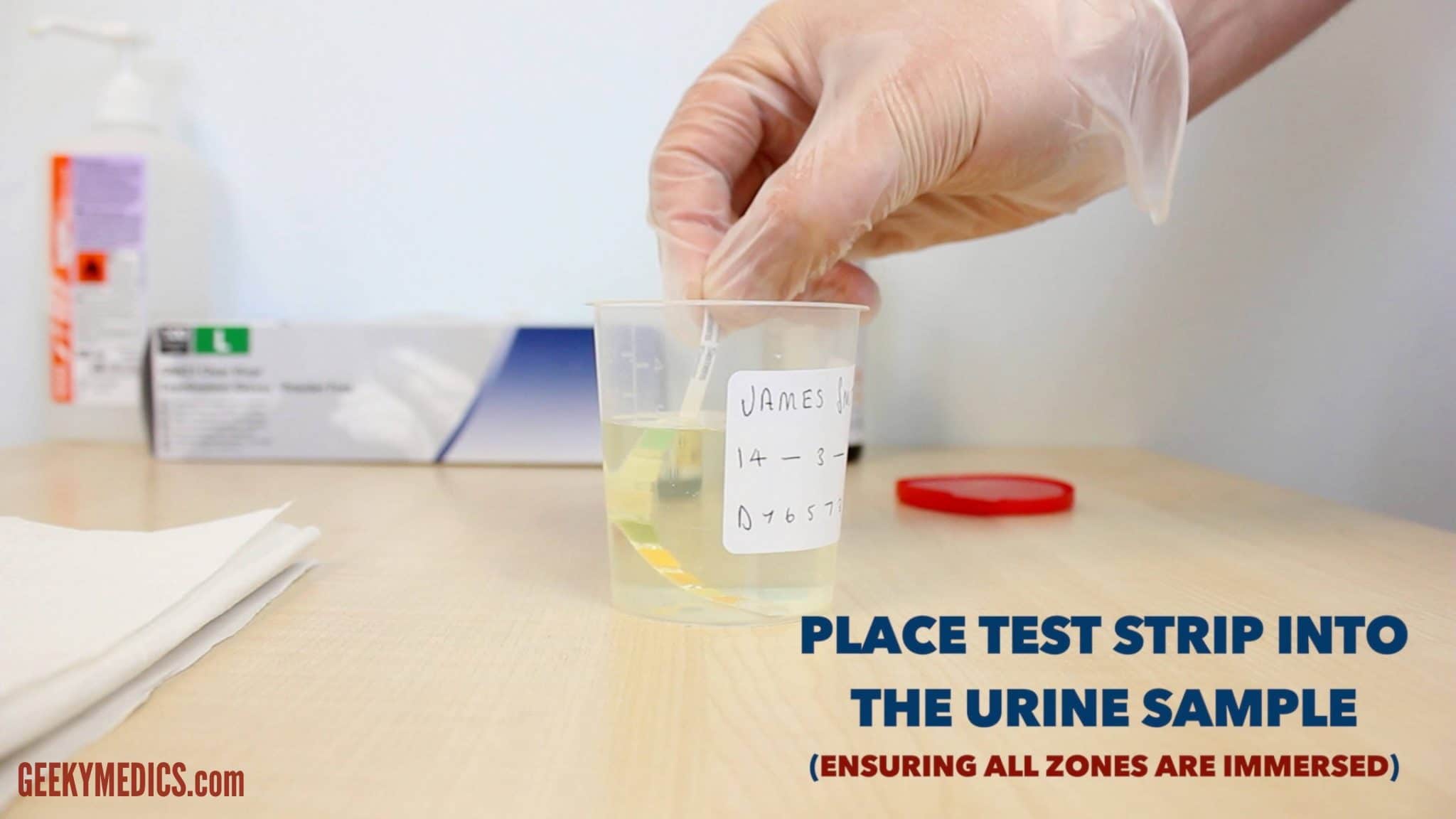 Urine feme test