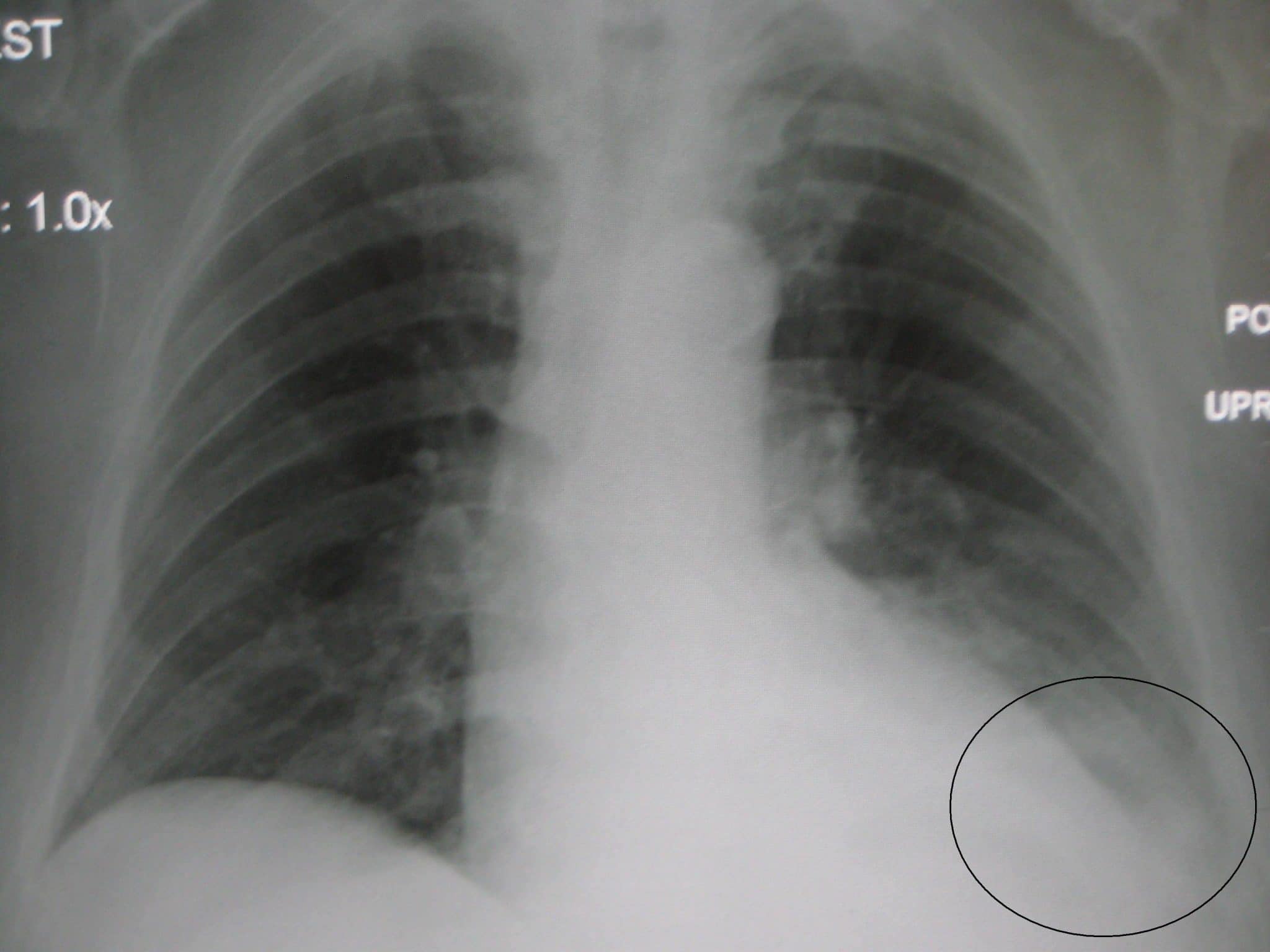 Chest X-ray Interpretation, A Structured Approach, Radiology