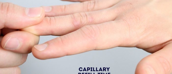 Check capillary refill time (CRT)