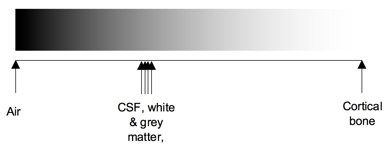 Figure 2 : A greyscale assigned the whole range of HU 