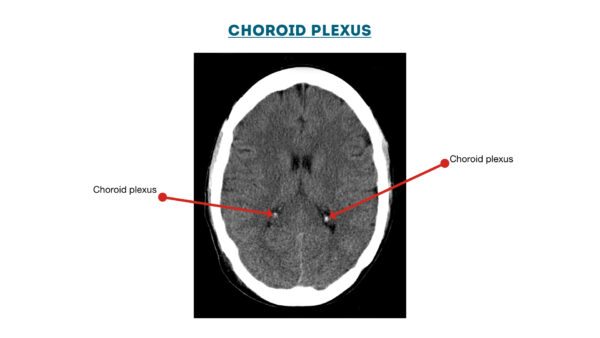 Choroid plexus diagram