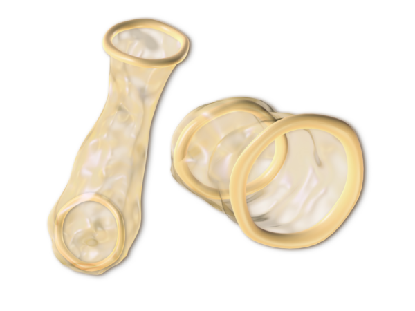Figure 2 Female condom