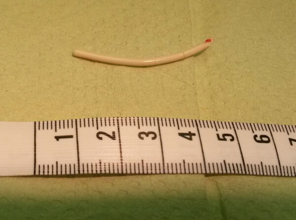 Figure 5 Contraceptive implant