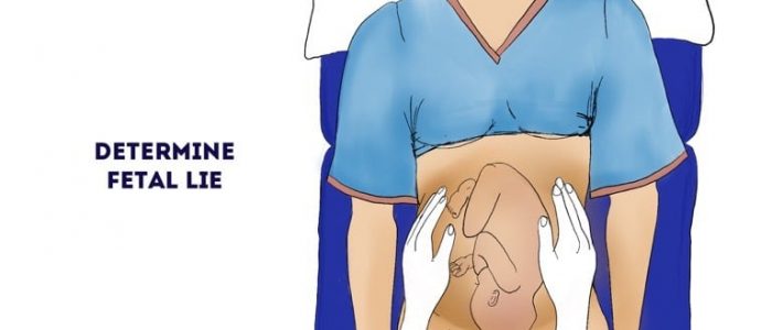 Obstetric abdominal examination (fetal lie)