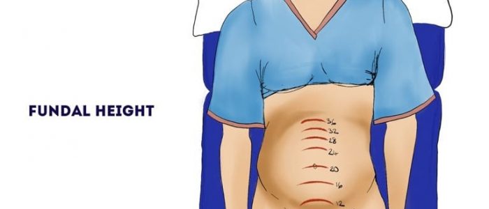 Fundal height (obstetric abdominal examination)