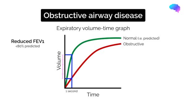 Spirometry interpretation - obstructive pattern