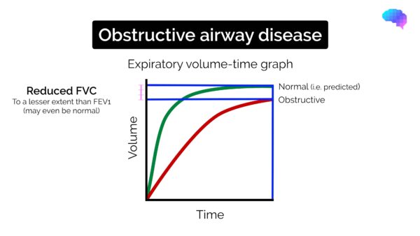 Spirometry interpretation - obstructive pattern