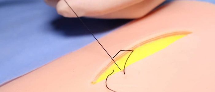 10. Pull your suture through, making sure both ends are on the same side of the suture; this will ensure your knot lies deep below the dermis