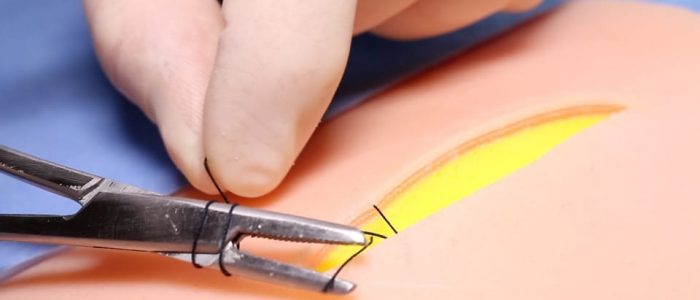 12. Grab the suture end