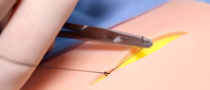 17. Pull your suture ends parallel to the wound again, this time in the opposite direction