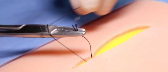 20. Grab the suture end