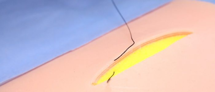 4. Pull through your suture; your suture end should lie deep in the wound
