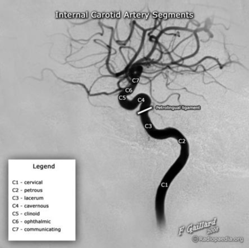Internal carotid artery sections
