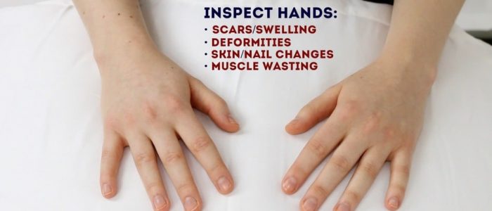 Inspect the dorsum of the hand