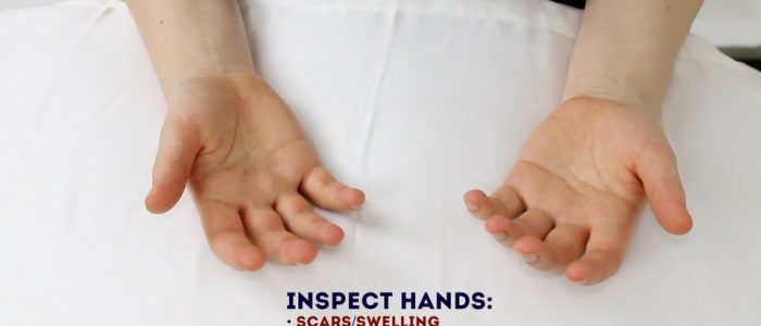 Inspect the palms