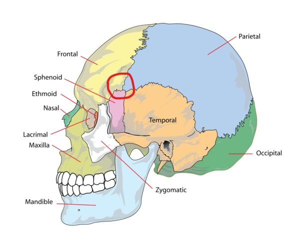 Diagram showing the bones of the skull with the pterion marked in red
