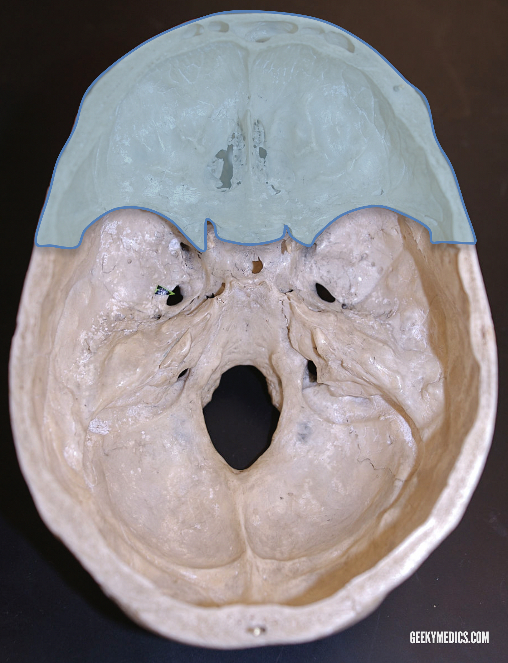 Cranial Foramina | Skull Anatomy | Foramen | Geeky Medics