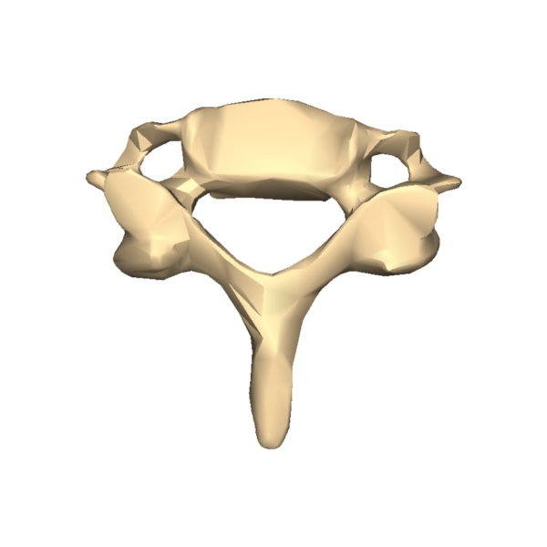 Typical cervical vertebra, transverse foramen foramina, bifid spinous process