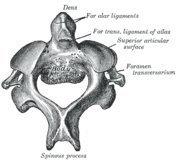 C2 vertebra - axis (atypical)