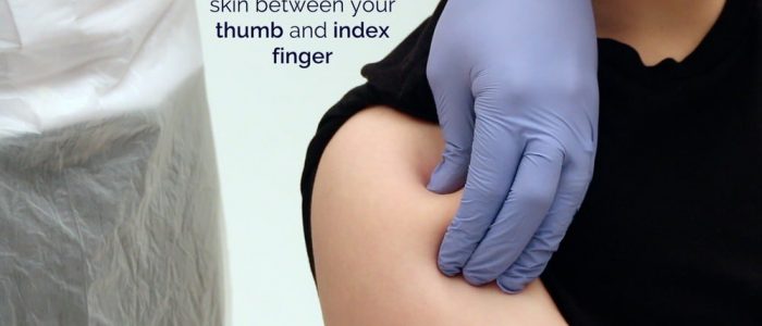 Pinch the patient's skin between your thumb and index finger