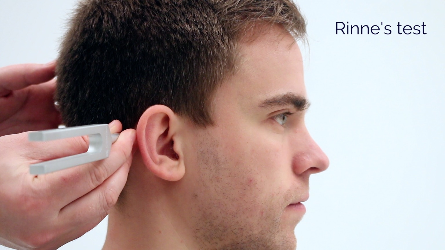 rinne test conductive hearing loss