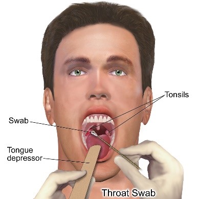 throat swab