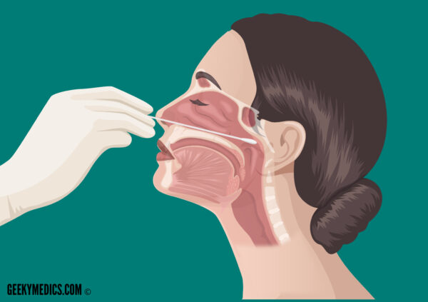 Nasopharyngeal and Oropharyngeal Swabs – OSCE Guide