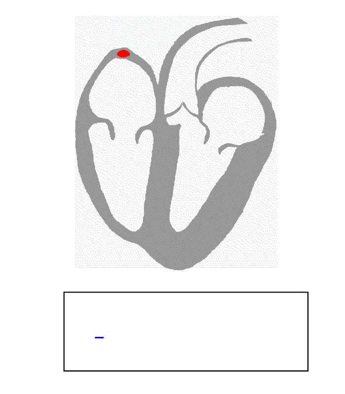 Spread of conduction through the heart