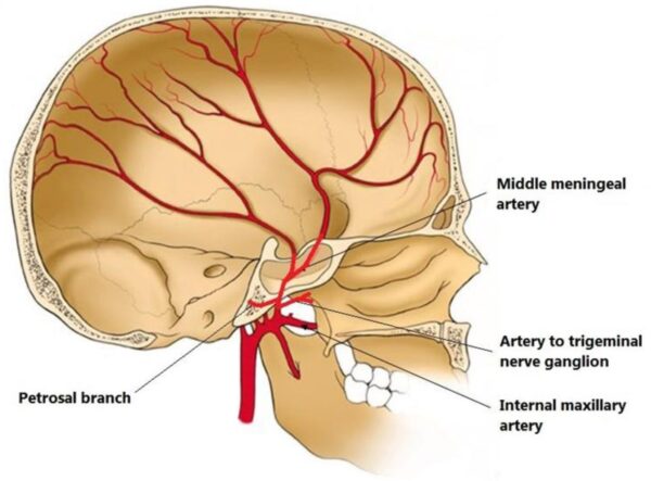 Anatomical course of the middle meningeal artery