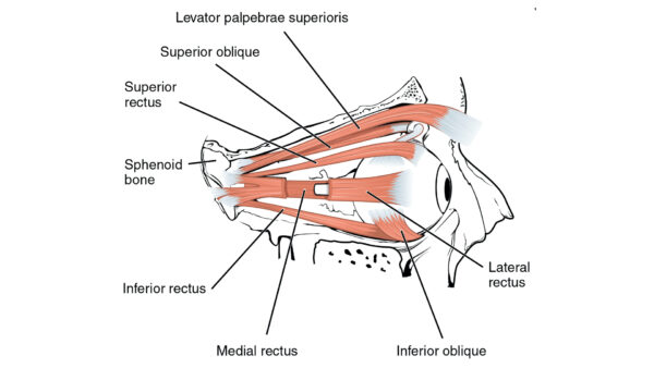 Figure-3. Lateral view of the right eye showing the levator palpebrae superioris superior to the superior oblique. 