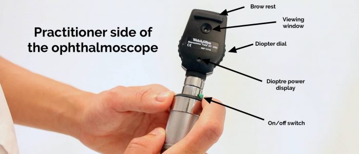 Practitioner side of the ophthalmoscope