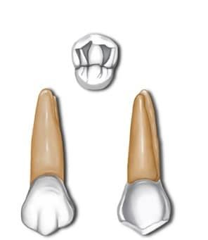 Permanent maxillary first premolar