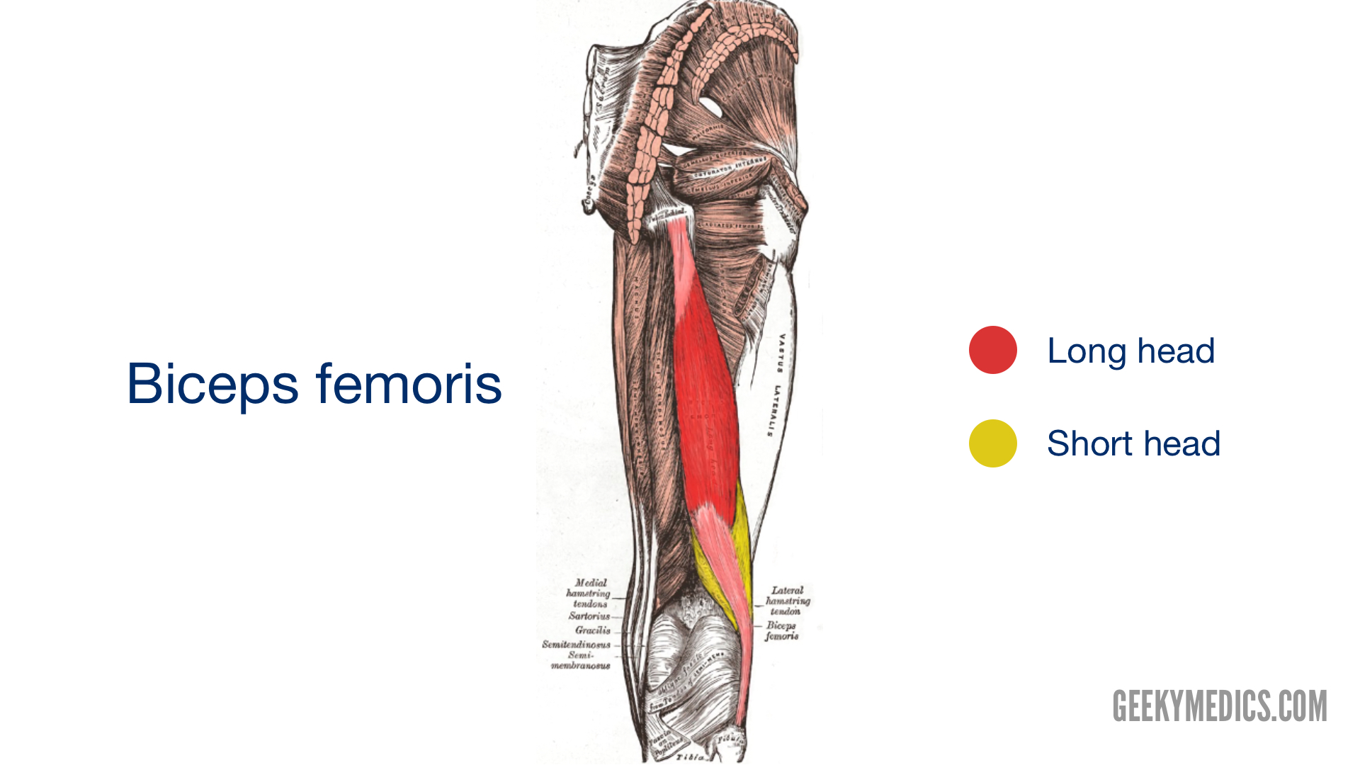 Muscles of the Posterior Thigh (Hamstrings)