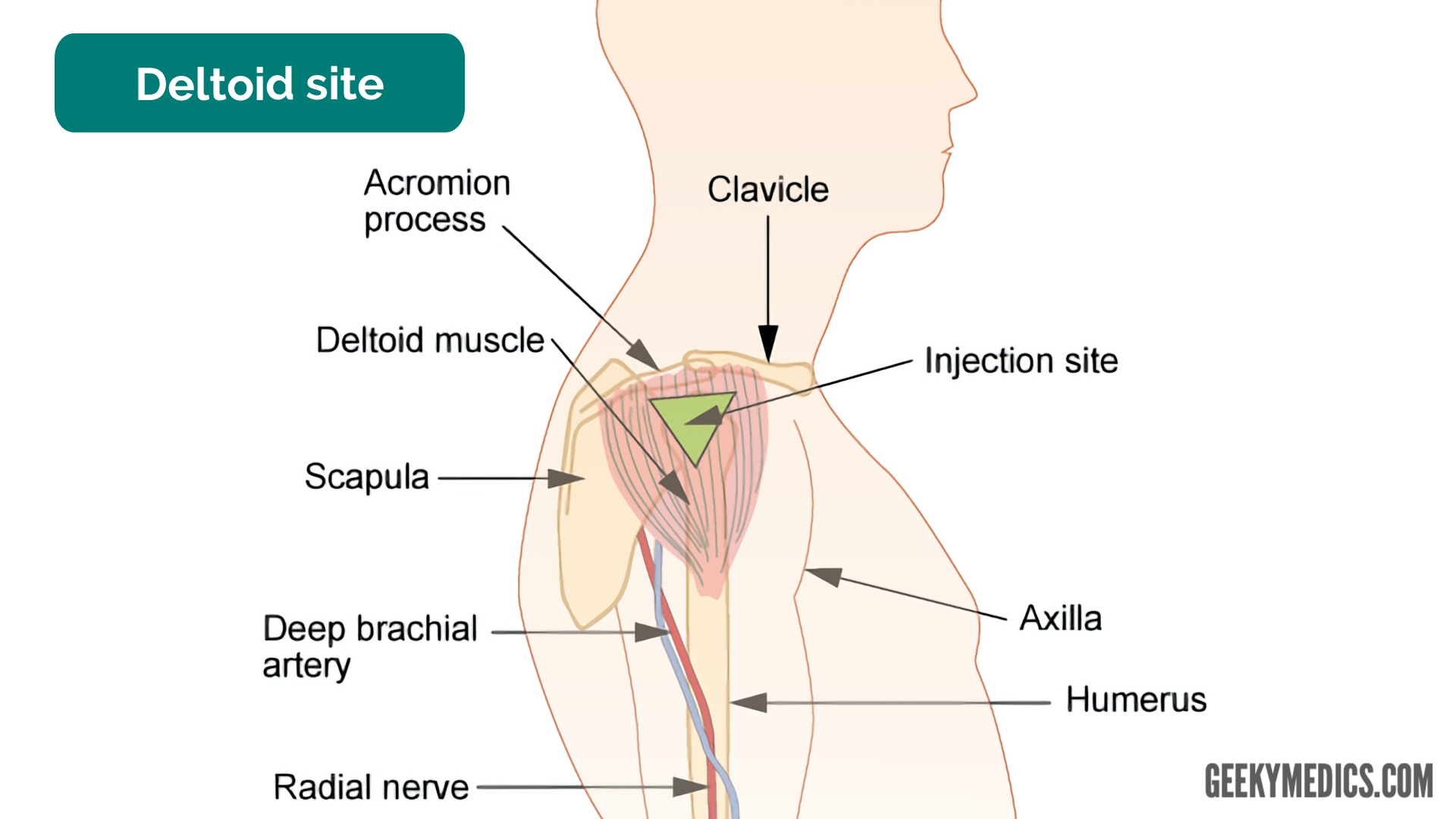 intramuscular injection deltoid