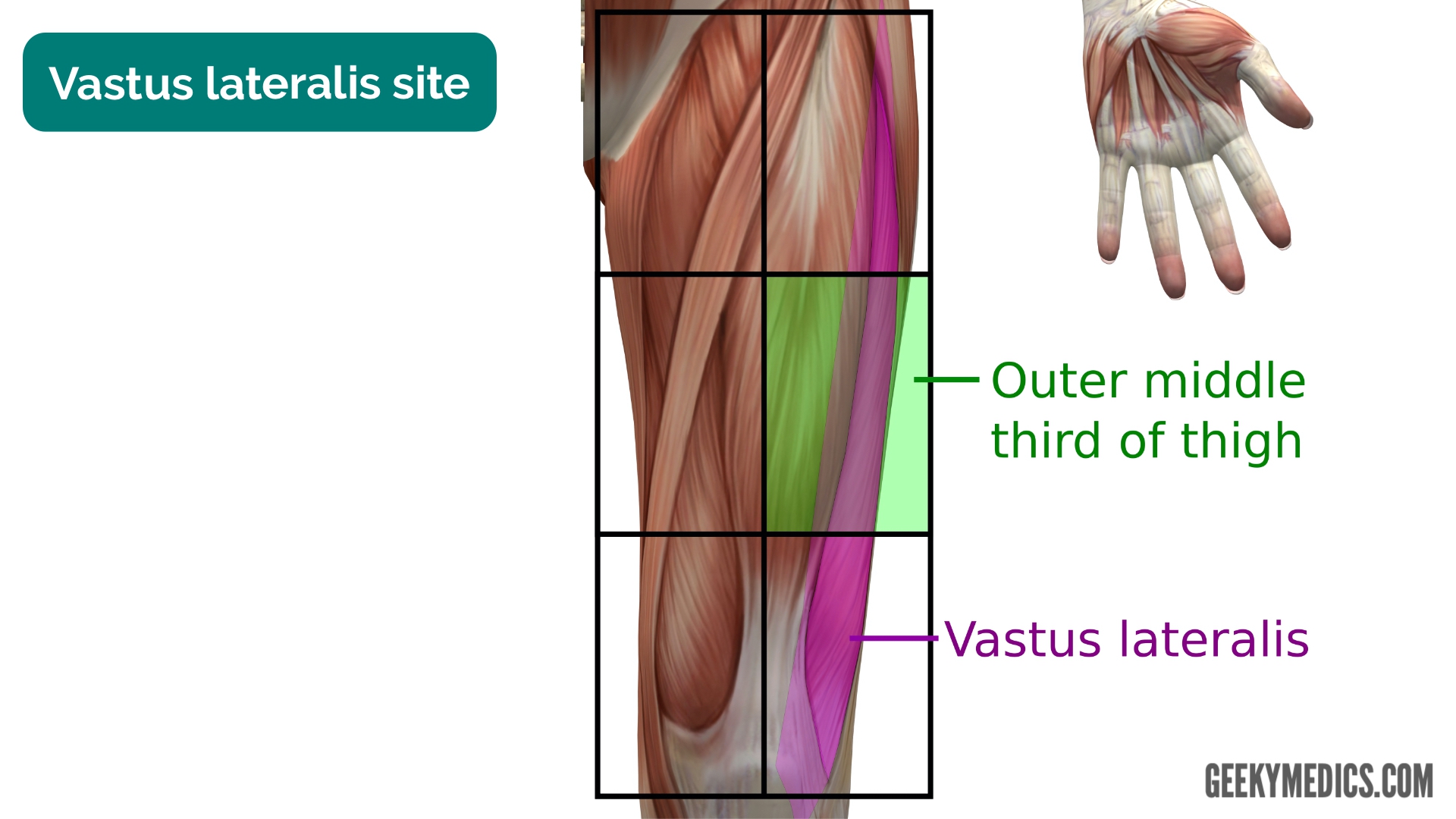 Vastus Lateralis Injection Site For Infants