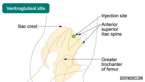 Ventrogluteal intramuscular injection site
